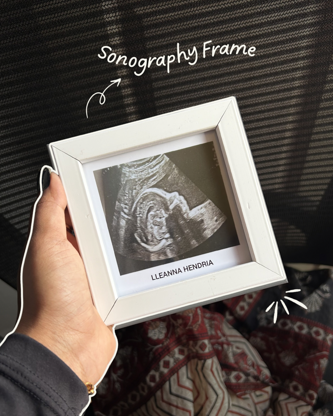 Sonography frame